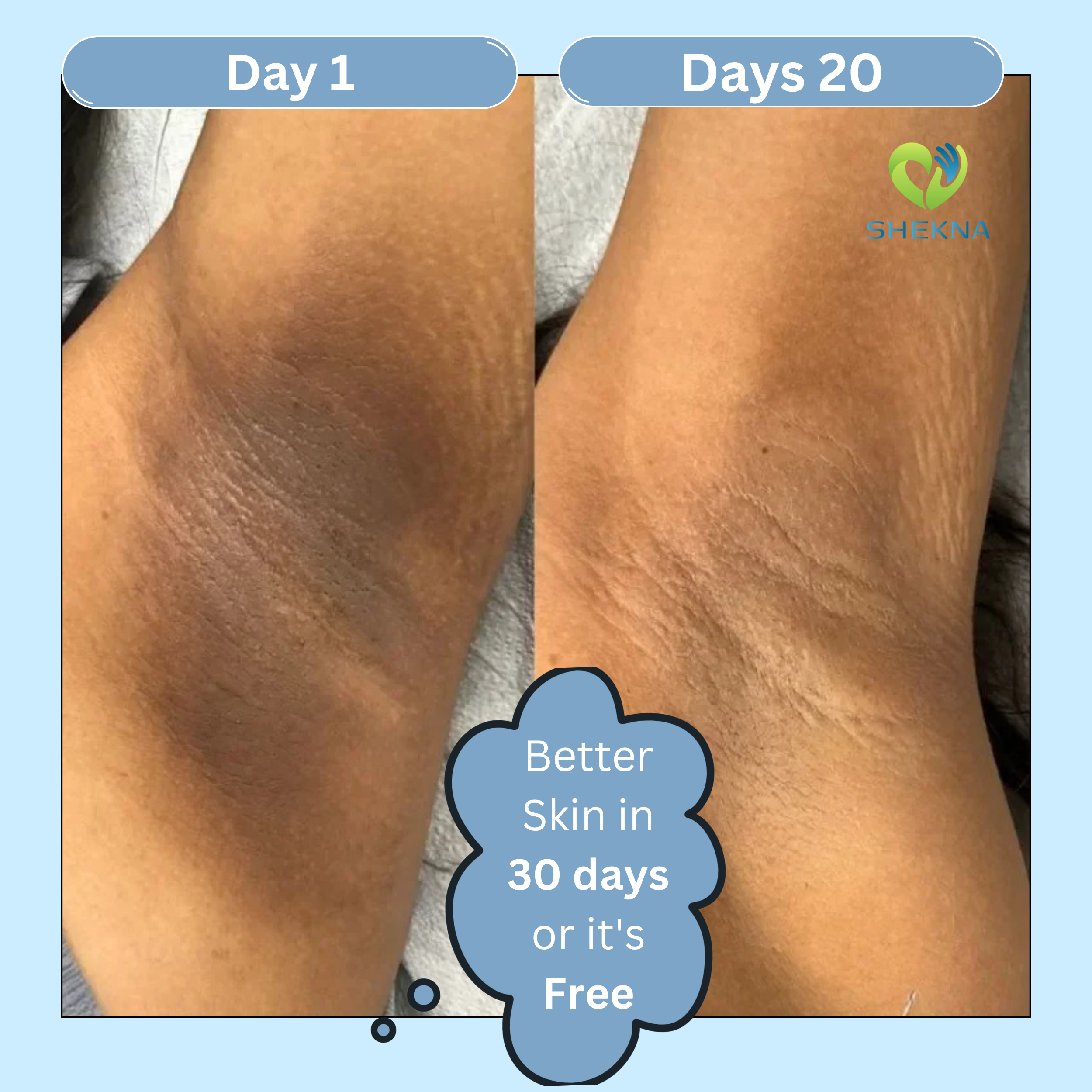 Kojic Acid & Turmeric Soap