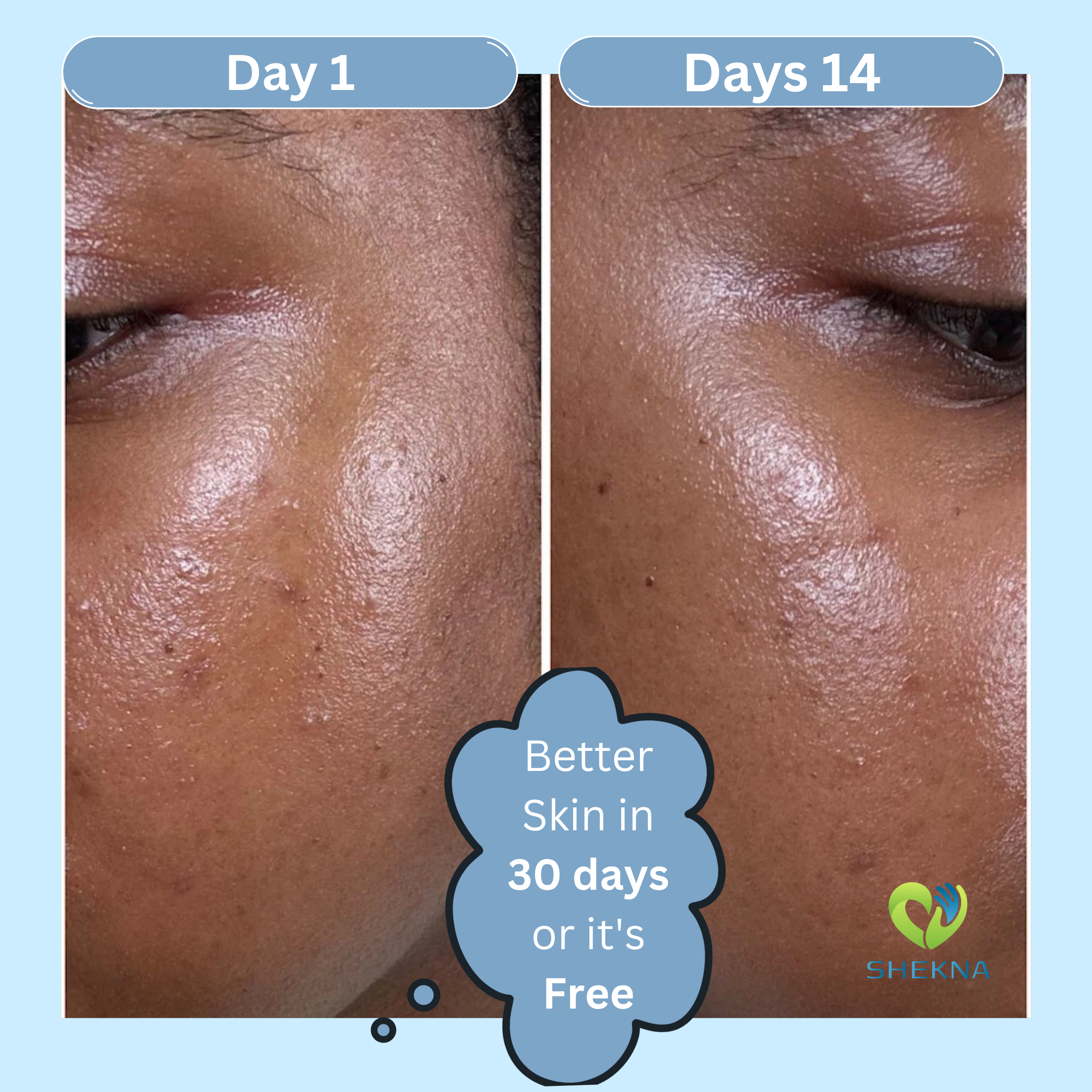 Kojic Acid & Turmeric Soap