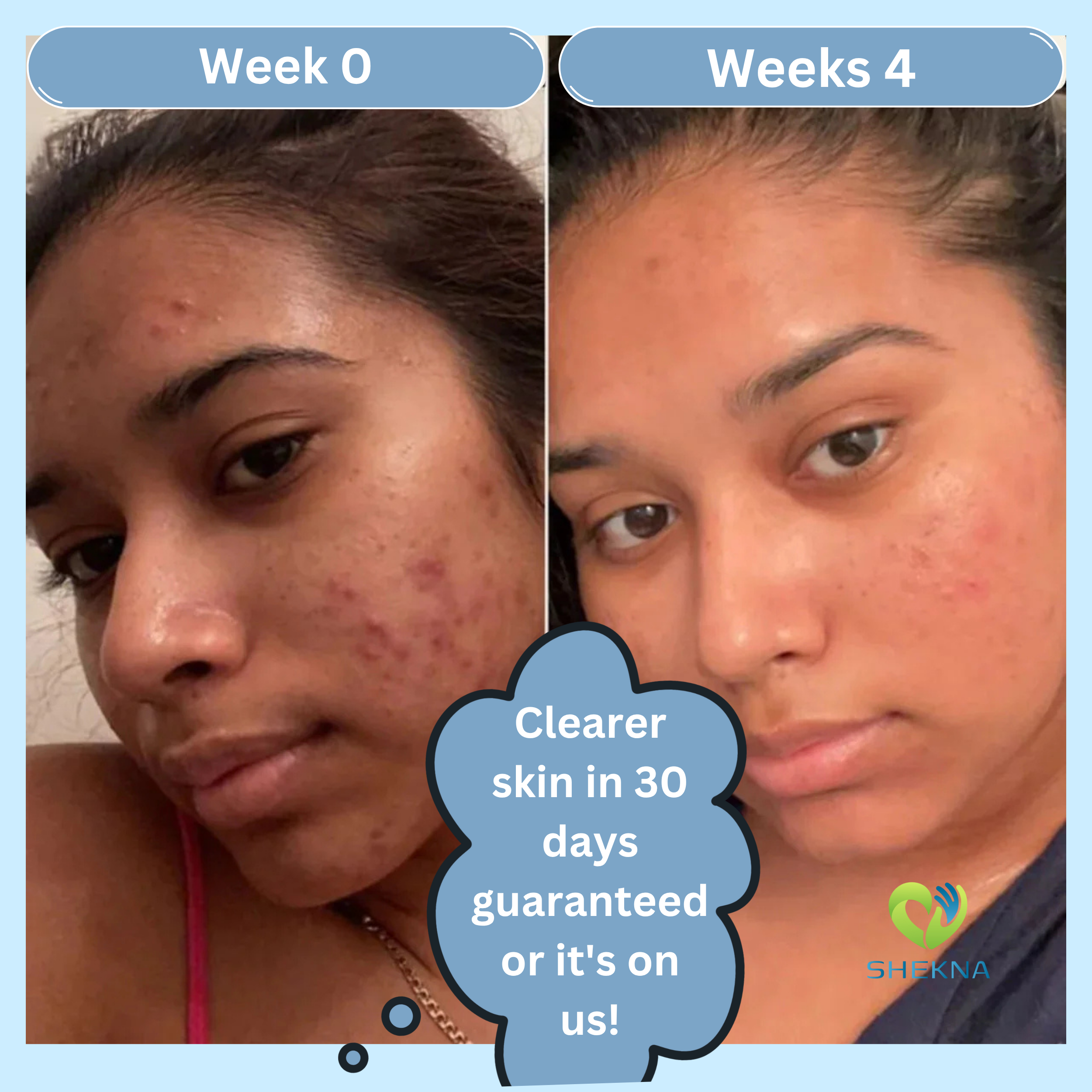 Kojic Acid & Turmeric Soap