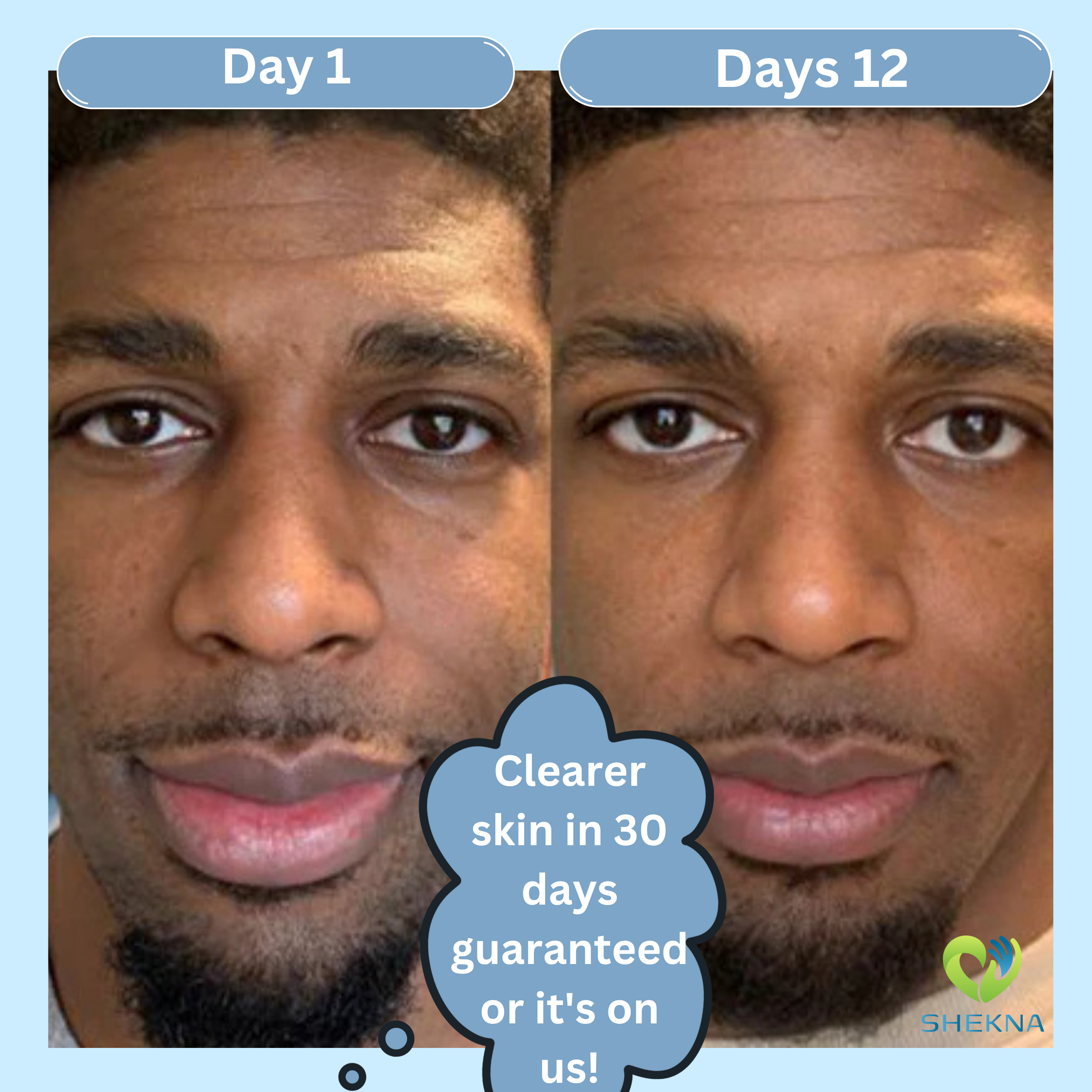 Kojic Acid & Turmeric Soap