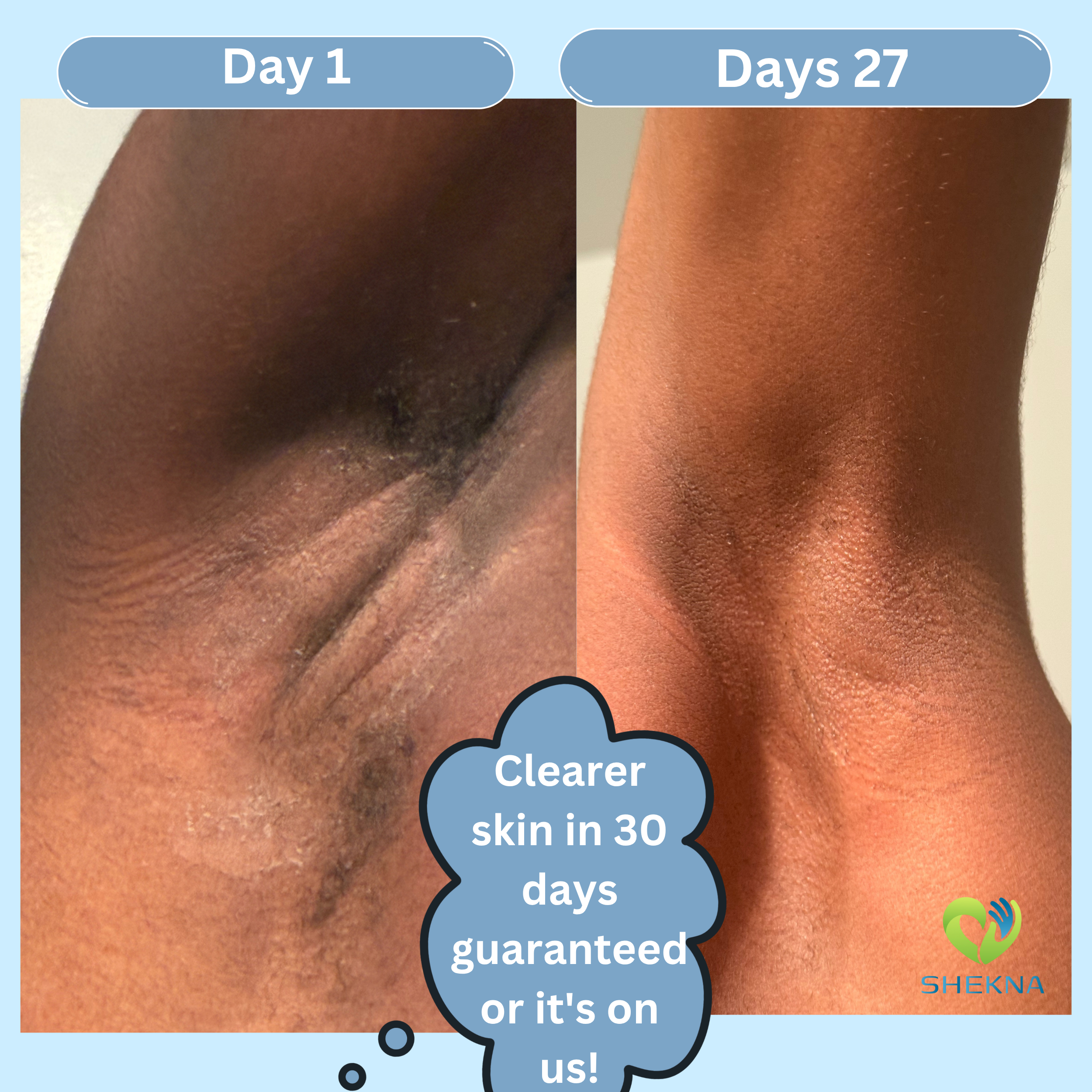 Kojic Acid & Turmeric Soap